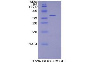 SDS-PAGE analysis of Rat Defensin beta 2 Protein. (beta 2 Defensin Protéine)