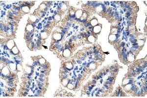 Human Intestine (ZNF785 anticorps  (C-Term))