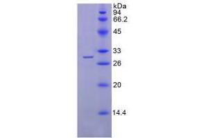 SDS-PAGE analysis of Human SGPL1 Protein. (SGPL1 Protéine)