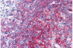 Human Spleen (formalin-fixed, paraffin-embedded) stained with CD40 antibody ABIN337317 at 10 ug/ml followed by biotinylated anti-mouse IgG secondary antibody ABIN481714, alkaline phosphatase-streptavidin and chromogen.