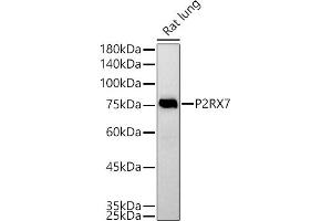 Western blot analysis of extracts of Rat lung, using P2RX7 antibody (ABIN6132452, ABIN6145122, ABIN6145123 and ABIN6214794) at 1:500 dilution.