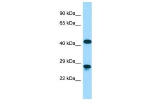 Host:  Rabbit  Target Name:  Dmbx1  Sample Type:  Mouse Stomach lysates  Antibody Dilution:  1. (DMBX1 anticorps  (C-Term))