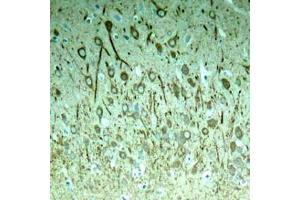 Immunohistochemical analysis of paraffin-embedded rat hippocampal region tissue from a model with Alzheimer (MAPT anticorps  (pThr231))