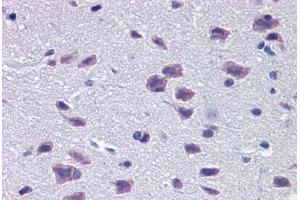 Mouse Brain: Formalin-Fixed, Paraffin-Embedded (FFPE) (DMBX1 anticorps  (AA 176-225))