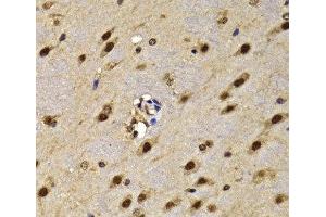 Immunohistochemistry of paraffin-embedded Mouse brain using HMG20A Polyclonal Antibody at dilution of 1:100 (40x lens). (HMG20A anticorps)