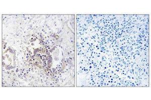 Immunohistochemistry (IHC) image for anti-Choroideremia-Like (Rab Escort Protein 2) (CHML) (Internal Region) antibody (ABIN1851922) (CHML anticorps  (Internal Region))