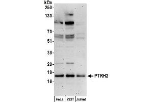 Western Blotting (WB) image for anti-Peptidyl-tRNA Hydrolase 2 (PTRH2) (AA 129-179) antibody (ABIN7453173)