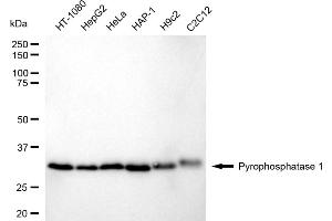 Western blotting analysis using Pyrophosphatase 1 antibody (ABIN7800077). (Recombinant Pyrophosphatase (Inorganic) 1 (PPA1) anticorps)