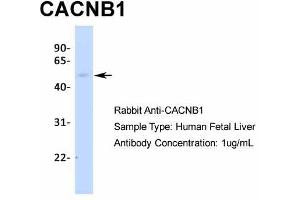 Host:  Rabbit  Target Name:  CACNB1  Sample Type:  Human Fetal Liver  Antibody Dilution:  1. (CACNB1 anticorps  (N-Term))