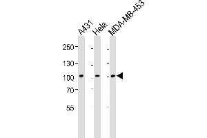 Western blot analysis of lysates from A431, Hela, MDA-MB-453 cell line (from left to right), using EPHB1 Antibody (H970) at 1:1000 at each lane. (EPH Receptor B1 anticorps  (C-Term))