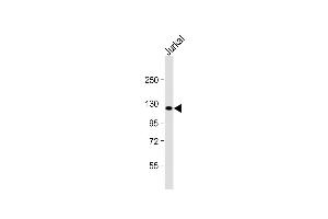 Anti-PRDM16 Antibody (Center) at 1:2000 dilution + Jurkat whole cell lysate Lysates/proteins at 20 μg per lane. (PRDM16 anticorps  (AA 771-804))