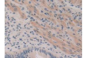 IHC-P analysis of Mouse Uterus Tissue, with DAB staining. (ROCK1 anticorps  (AA 1094-1323))