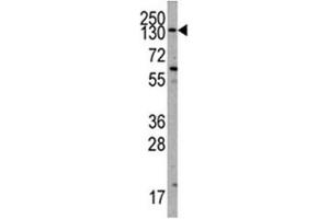Western blot analysis of PIK3CA antibody and K562 lysate