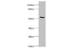 Western blot All lanes: ALG1 antibody at 10 μg/mL + Hela whole cell lysate Secondary Goat polyclonal to rabbit IgG at 1/10000 dilution Predicted band size: 53, 41 kDa Observed band size: 53 kDa (ALG1 anticorps  (AA 215-464))