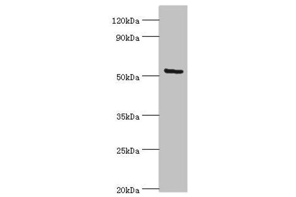 ALG1 Antikörper  (AA 215-464)