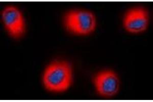 Immunofluorescent analysis of STEAP2 staining in HEK293T cells. (STEAP2 anticorps  (C-Term))