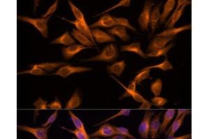 Immunofluorescence analysis of HeLa cells using UNG Polyclonal Antibody at dilution of 1:100. (UNG anticorps)