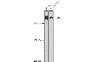 Western blot analysis of extracts of various cell lines, using ATR antibody (ABIN6131207, ABIN6137357, ABIN6137359 and ABIN6218135) at 1:500 dilution.