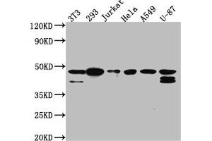 Western Blot Positive WB detected in: NIH/3T3 whole cell lysate, 293 whole cell lysate, Jurkat whole cell lysate, Hela whole cell lysate, A549 whole cell lysate, U-87 whole cell lysate All lanes: CKII alpha antibody at 1:1000 Secondary Goat polyclonal to rabbit IgG at 1/50000 dilution Predicted band size: 46, 30 kDa Observed band size: 45 kDa (Recombinant CSNK2A1/CK II alpha anticorps)