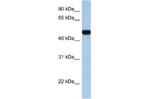 WB Suggested Anti-SLC25A46 Antibody Titration:  0. (SLC25A46 anticorps  (C-Term))