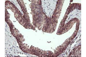 Image no. 11 for anti-Haloacid Dehalogenase-Like Hydrolase Domain Containing 1 (HDHD1) antibody (ABIN1498623) (HDHD1 anticorps)