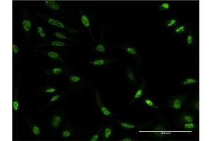 Immunofluorescence of monoclonal antibody to AKT3 on HeLa cell. (AKT3 anticorps  (AA 100-189))
