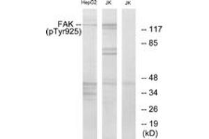 Western blot analysis of extracts from Jurkat and HepG2 cells, using FAK (Phospho-Tyr925) Antibody. (FAK anticorps  (pTyr925))