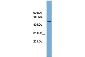 WB Suggested Anti-EFCAB3 Antibody Titration: 0. (EFCAB3 anticorps  (N-Term))