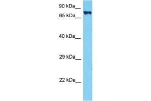 Host:  Rabbit  Target Name:  HGF  Sample Type:  293T Whole Cell lysates  Antibody Dilution:  0.
