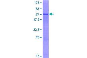 Image no. 1 for Lactate Dehydrogenase C (LDHC) (AA 1-332) protein (GST tag) (ABIN1309271)