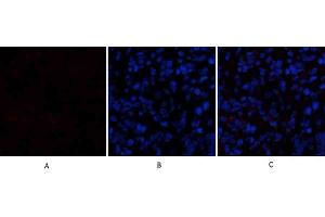 Immunofluorescence analysis of rat lung tissue. (Cadherin 5 anticorps  (Internal Region))