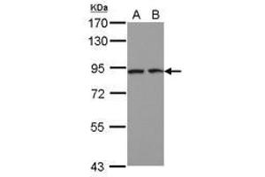 Image no. 2 for anti-Discoidin, CUB and LCCL Domain Containing 2 (DCBLD2) (AA 489-750) antibody (ABIN1497772) (DCBLD2 anticorps  (AA 489-750))