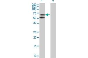 Western Blot analysis of ALB expression in transfected 293T cell line by ALB MaxPab polyclonal antibody. (Albumin anticorps  (AA 1-609))