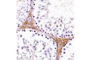 Immunohistochemistry of paraffin embedded rat testis using SLC7A8 (ABIN7074503) at dilution of 1:1100 (400x lens) (LAT2 anticorps)