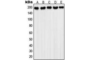 Western blot analysis of PDGFR alpha expression in HepG2 (A), NIH3T3 (B), Saos2 (C), HeLa (D), A431 (E) whole cell lysates. (PDGFRA anticorps  (C-Term))