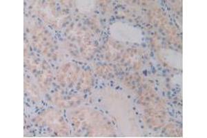IHC-P analysis of Human Kidney Tissue, with DAB staining. (FLNC anticorps  (AA 17-259))