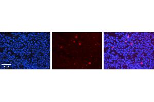 Rabbit Anti-CRKL Antibody Catalog Number: ARP30524_P050 Formalin Fixed Paraffin Embedded Tissue: Human Lymph Node Tissue Observed Staining: Plasma membrane, Cytoplasm Primary Antibody Concentration: 1:100 Other Working Concentrations: 1:600 Secondary Antibody: Donkey anti-Rabbit-Cy3 Secondary Antibody Concentration: 1:200 Magnification: 20X Exposure Time: 0.