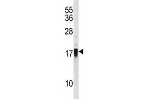 CD70 antibody western blot analysis in NCI-H460 lysate (CD70 anticorps  (AA 72-101))