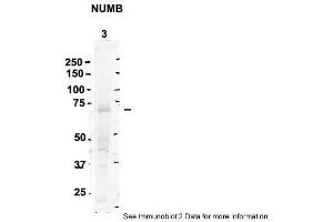 Sample Type: 3. (NUMB anticorps  (C-Term))