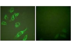 Immunofluorescence analysis of HeLa cells treated with PMA 125ng/ml 30', using 14-3-3 zeta (Phospho-Ser58) Antibody. (14-3-3 zeta anticorps  (pSer58))