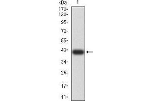 Western blot analysis using C3C mAb against human C3C (AA: 1521-1649) recombinant protein. (Complement C3c anticorps  (AA 1521-1649))