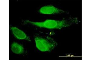 Image no. 3 for anti-Peroxiredoxin 2 (PRDX2) (AA 1-199) antibody (ABIN598967) (Peroxiredoxin 2 anticorps  (AA 1-199))