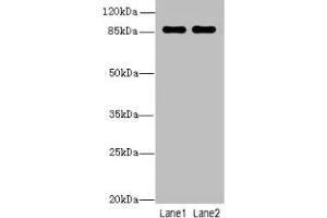 Western blot All lanes: VWA5A antibody at 1 μg/mL Lane 1: A549 whole cell lysate Lane 2: MCF-7 whole cell lysate Secondary Goat polyclonal to rabbit IgG at 1/10000 dilution Predicted band size: 87, 48, 46, 30 kDa Observed band size: 87 kDa