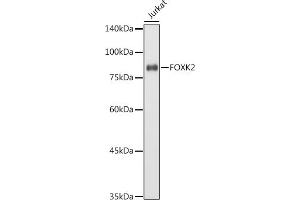 Western blot analysis of extracts of Jurkat cells, using FOXK2 antibody (ABIN7267238) at 1:1000 dilution. (Forkhead Box K2 anticorps  (AA 511-660))