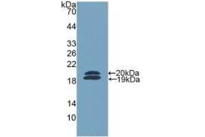 Detection of Recombinant FCN2, Mouse using Polyclonal Antibody to Ficolin 2 (FCN2) (Ficolin 2 anticorps  (AA 97-254))