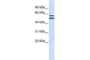 WB Suggested Anti-PIGQ Antibody Titration:  0.