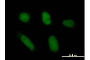 Immunofluorescence of purified MaxPab antibody to ANXA5 on HeLa cell. (Annexin V anticorps  (AA 1-320))