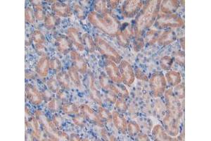 IHC-P analysis of Mouse Kidney Tissue, with DAB staining. (HEXB anticorps  (AA 101-217))