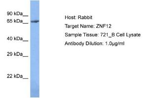 Host: Rabbit Target Name: ZNF12 Sample Type: 721_B Whole Cell lysates Antibody Dilution: 1. (ZNF12 anticorps  (N-Term))