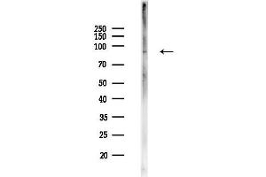 Western blot analysis of lysates from PC12 cells(heat-shock,45 min treatment), using Phospho-FOXO3A (Ser7) Antibody at 1/1000 dilution.
